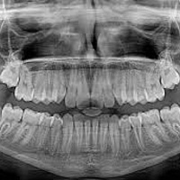 dental X ray
